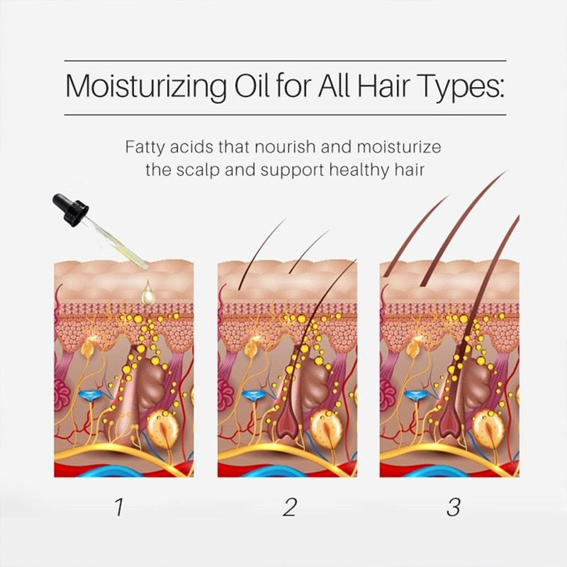 50ml Onion Oil Hair Growth Products Fast Growing Hair Oil Loss Care Liquid Hair Scalp Treatment Beauty Health Hair Growth Serum