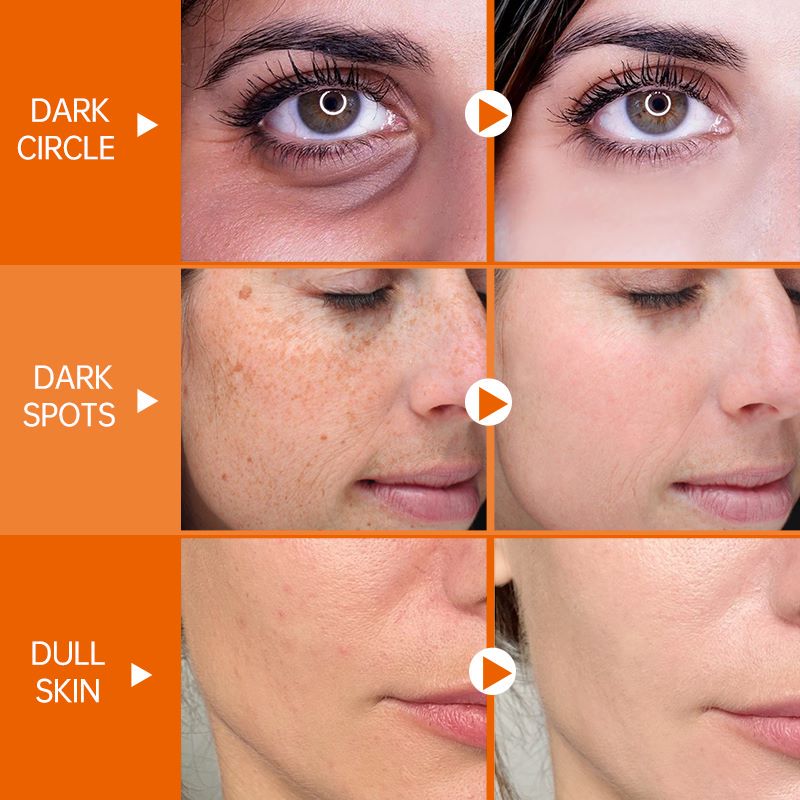 JoyPretty Vitamin C Whitening Skin Care Set Glutathione Face Cream Emulsions Serum Skin Whitener Korean Skin Care Products 5PCS